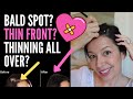 HIDING THINNING HAIR ON TOP FOR FEMALES: HAIRSTYLE Tips For BALD Spots, Thin Fronts And Parts!