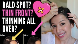 HIDING THINNING HAIR ON TOP FOR FEMALES: HAIRSTYLE Tips For BALD Spots, Thin Fronts And Parts!