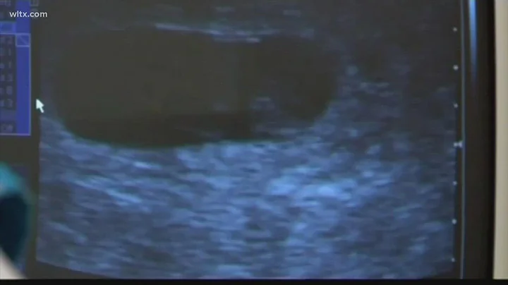 Abortion floor debate splits South Carolina Republicans