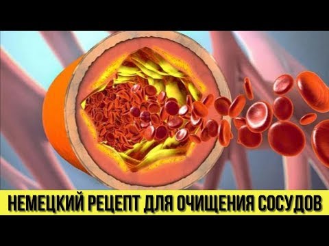 Проверенный НЕМЕЦКИЙ РЕЦЕПТ для ОЧИЩЕНИЯ СОСУДОВ Это очень ПРОСТО сделать в домашних условиях