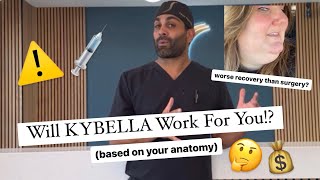 How To Know If Kybella Will Work For YOU!