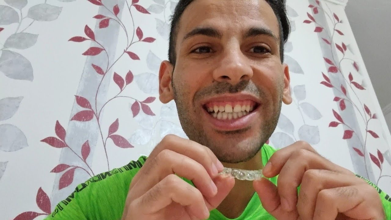 تجربتي في آخر يوم التقويم الشفاف الانفزلاين