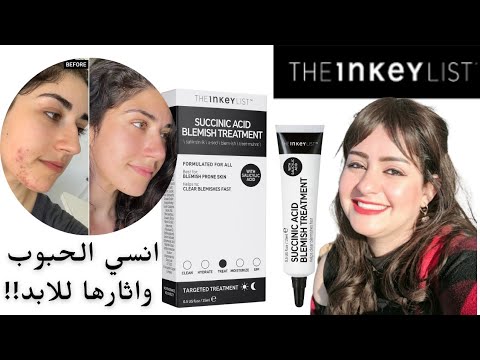 وداعا حبايه المناسبات الشقيه في ٢٤ ساعه       