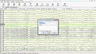 Neuron Spectrum NET  generating exam's report