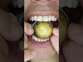 ASMR | Venus Planet Gum Ball