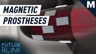 Magnets Can Make Prosthetic Limbs More Versatile and Easier to Control | Mashable