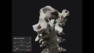 Biomechanics Of The Spine App - Craniocervical Junction