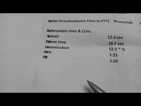 تحليل السيولة فحص  وتفسير ارتفاعه وانخفاضه