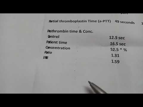 فيديو: لماذا يتم إجراء اختبار pt inr؟