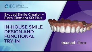 Exocad Smile Creator + iTero Element 5D Plus. In-house Smile Design and Functional Try-In screenshot 5