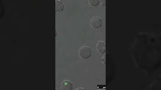 Attachment of Babesia bovis merozoites to the RBCs.