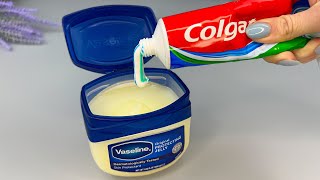 Just mix Toothpaste with Vaseline and you will be amazed!