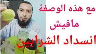 علاج انسداد الشرايين بالأعشاب أسهل وأسرع وصفة