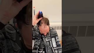 Watch my client shave his head and get a hair tattoo #scalpmicropigmentation