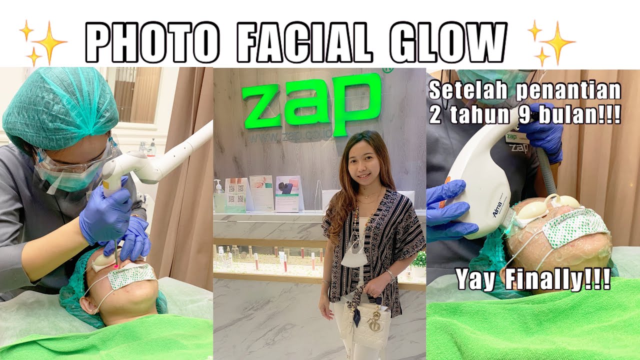 PHOTO FACIAL GLOW ZAP REVIEW YouTube