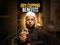 Dry Cupping Se Pain Relief Kaise Hota Hai? | Hijama Cupping#hijama