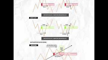 Head & Shoulder Pattern 🔥 Most Trusted Reversal Setup
