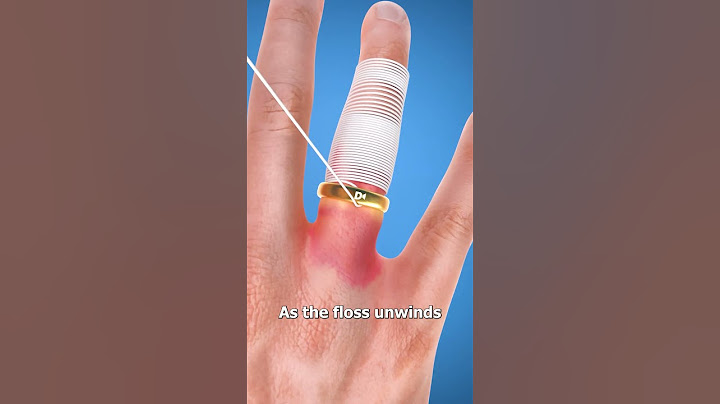 How To Get A Stuck Ring Off 🤔