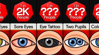 Download Lagu Comparison: Types of Eyes MP3