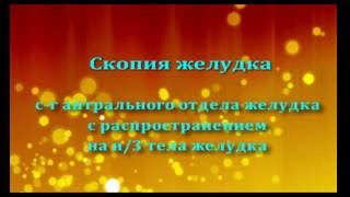 с r антрального отдела желудка с r антрального отдела желудка