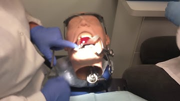 AMALGAM PROCEDURE