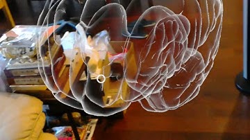 HoloAnatomy Brain from HoloLens Demo
