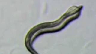 'Worm porn' video shows details of nematode sex