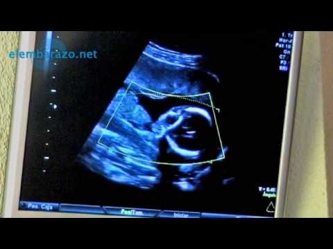 Video: ¿A las cuantas semanas se forma el género del bebé?