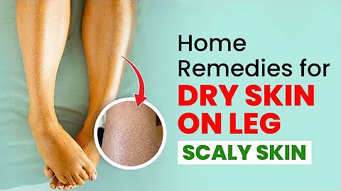 Dry Skin Solutions: Easy Home Remedies for Legs