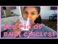 DIY: Get Rid of Dark Circles and Wrinkles Under Eyes Naturally