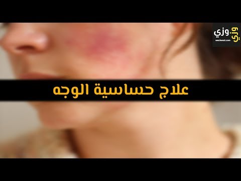 أهم علاج حساسية الوجه