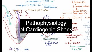 Pathophysiology of Cardiogenic Shock