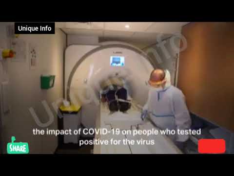 The Oxford University Hospitals is based on scans performed research of Covid-19.