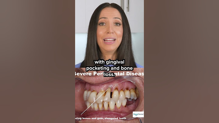 if you have gum disease, do this! #shorts