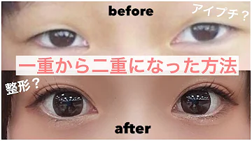 一か月で永久二重になった方法 一か月で永久二重になった方法