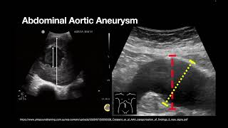 AAA and ABDO Emergencies