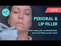 Treating Perioral Lines, Jowls &amp; the Jawline 💎 GEM© Clinic Full Face Filler Case Study - Zoe, Part 3