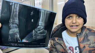 Pair Me Khatarnak Chot Lag Gayi 🥺 | Cycle Ride gone wrong | Yaatri