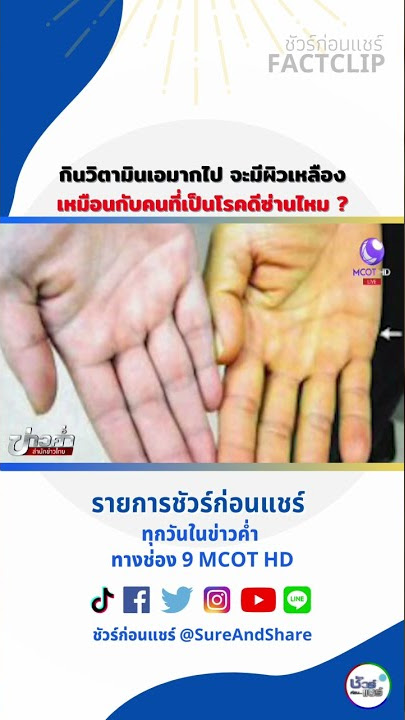กินวิตามินเอมากไป จะมีผิวเหลืองเหมือนกับคนที่เป็นโรคดีซ่านไหม ?