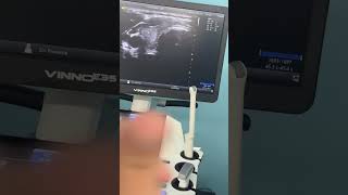 IMAGENO SEM 1 (2) PRA