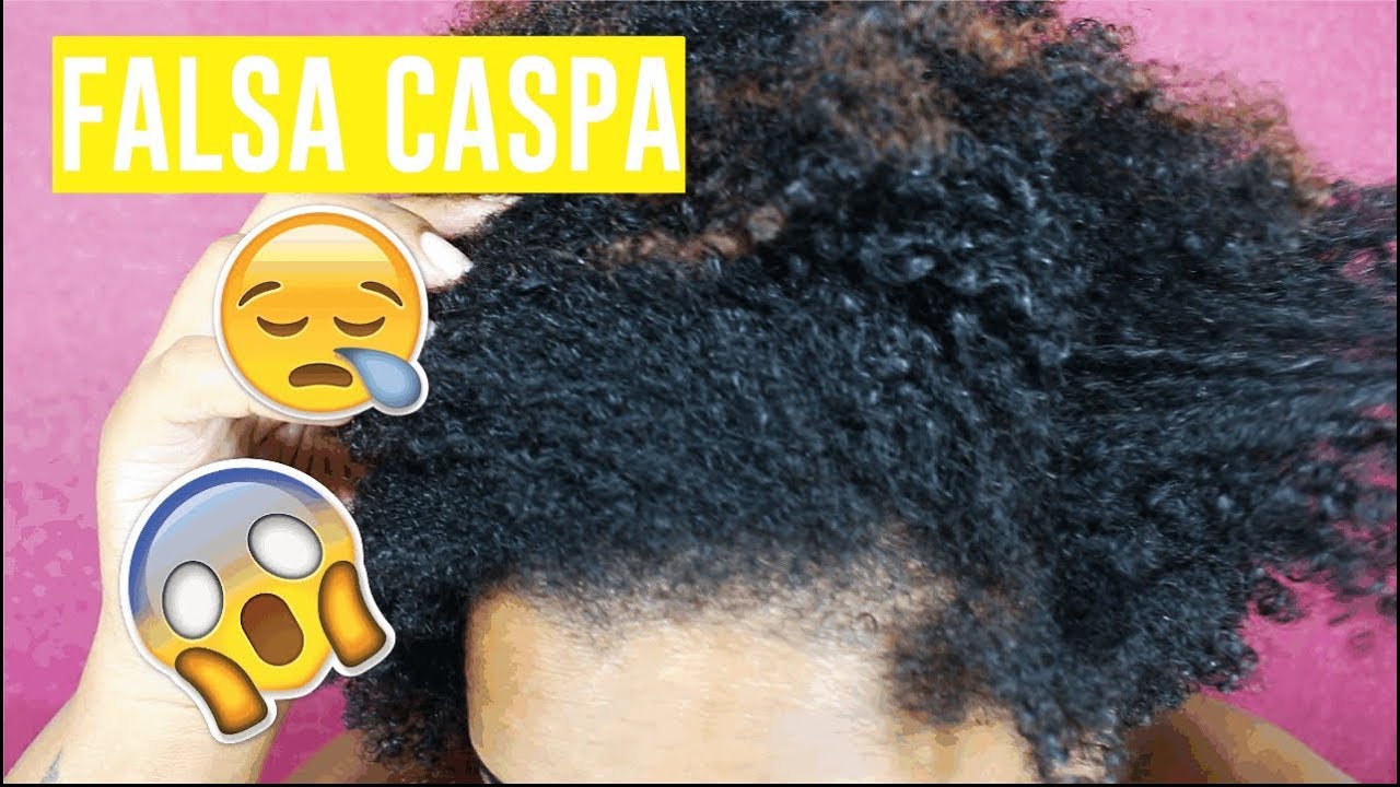 DICAS e truques para EVITAR a FALSA CASPA | Patrícia Avelino