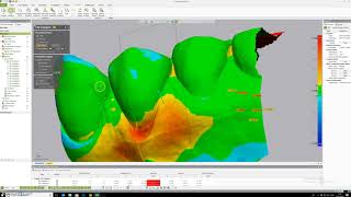 Geomagic Soft Tissue Measurement screenshot 2