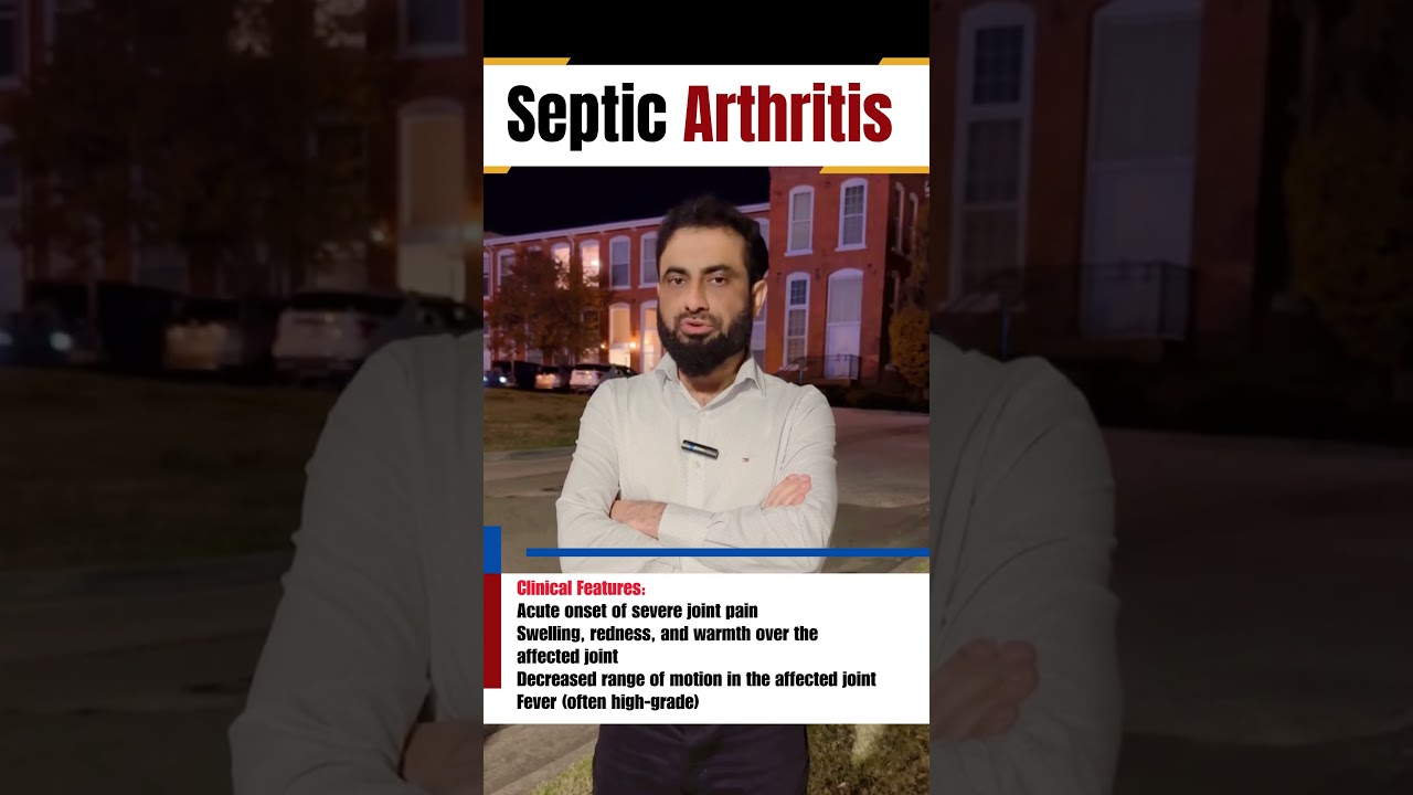 Septic Arthritis | Exam Key Points | Dr Hafiz Atif | AMC, NRE, FCPS, & UAE Exams