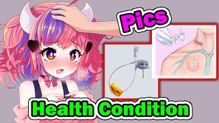 Ironmouse Scares Everyone with her Health Condition