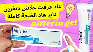 تجربتي مع differin gel | ديفرين للوجه