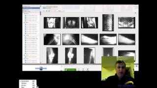 OMG EMR Tutorial: The Basics of EMR and Templates Part 1 screenshot 4