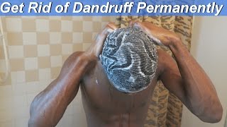 How to Get Rid of Dandruff at Home: Naturally & Permanently!