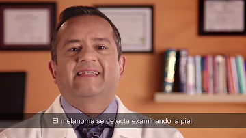 Qual exame para saber se tem melanoma?