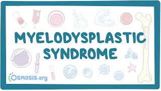 Myelodysplastic syndromes  causes, symptoms, diagnosis, treatment, pathology