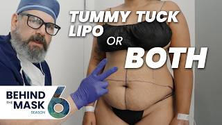 Tummy Tuck vs Liposuction: STOP Guessing | BTM S6 E16